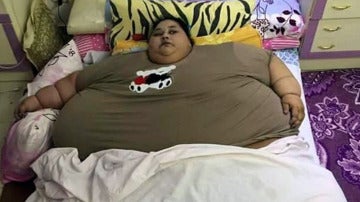 Eman Ahmed, la mujer más obesa del mundo