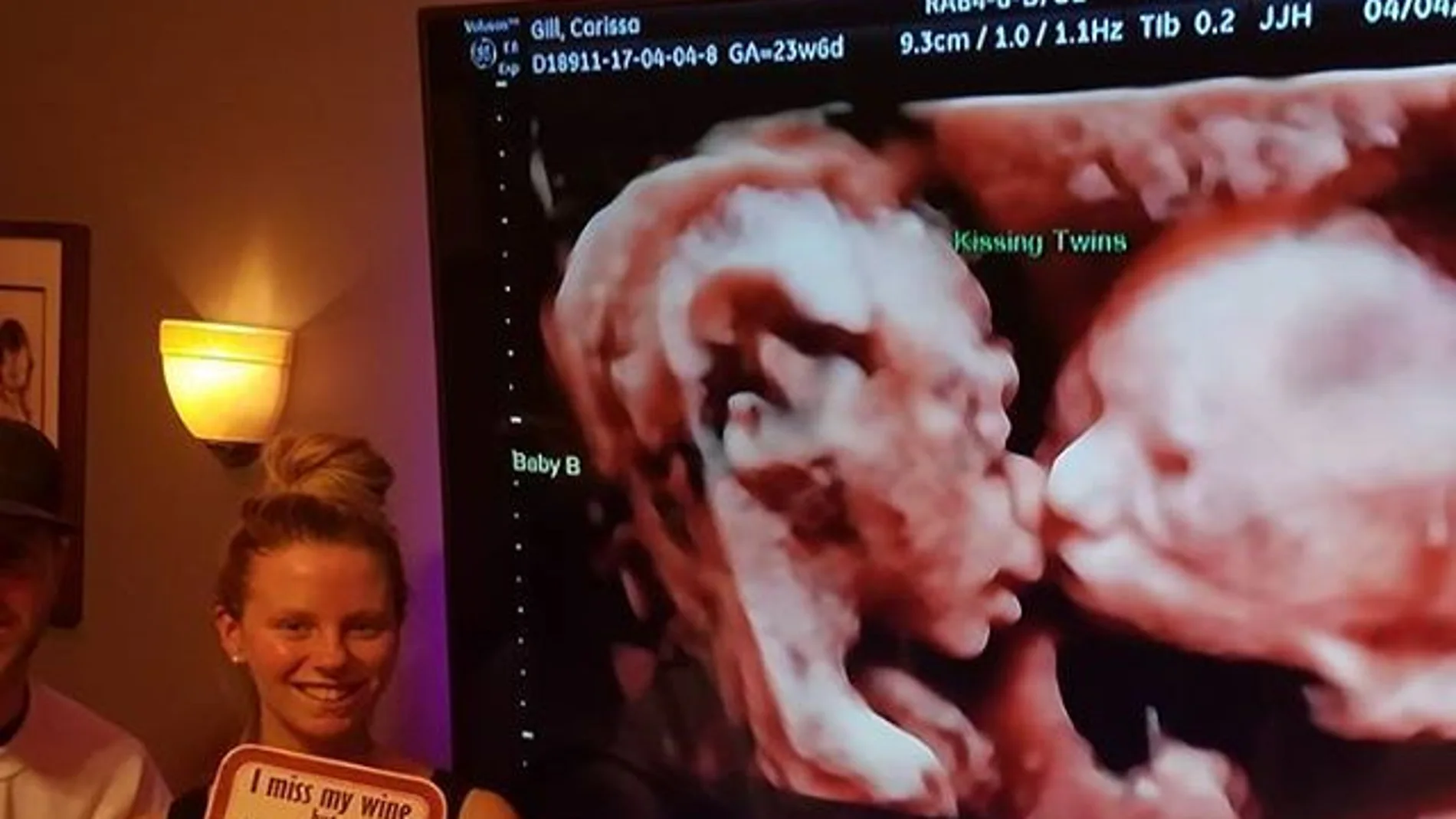 Una ecografía 4D dándose un beso Una ecografía 4D dándose un beso