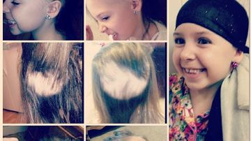 Así fue evolucionando la alopecia de Gianessa