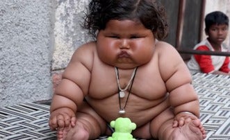 Chahat Kumar, la bebé obesa