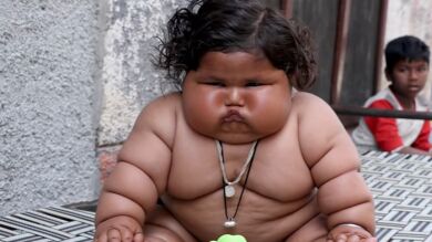 La historia de Chahat, una bebé de ocho meses que pesa 17 kilos: 