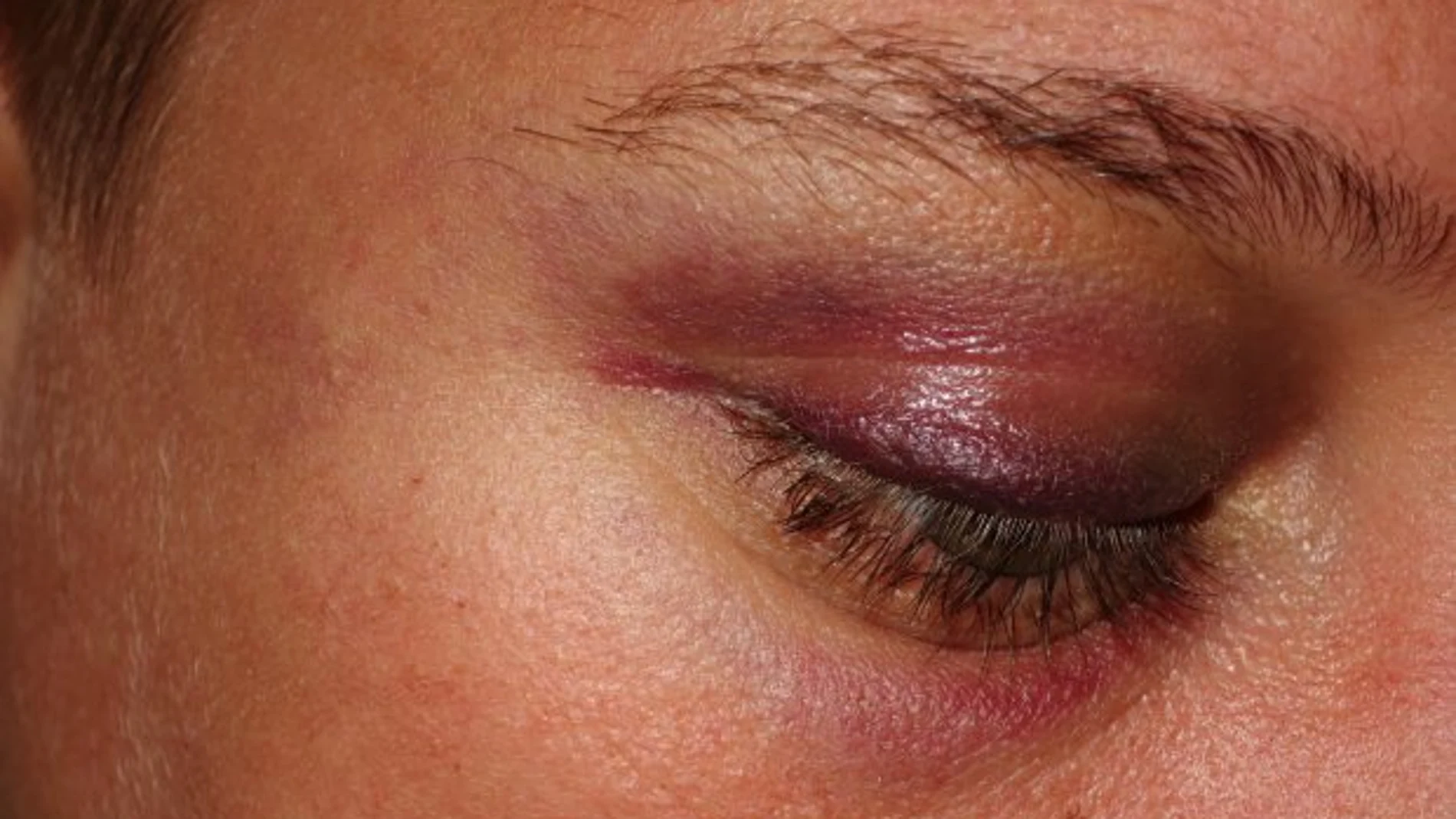 Agresión a un grupo de lesbianas en Reino Unido Agresión a un grupo de lesbianas en Reino Unido