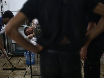 Un joven sirio recibe tratamiento médico en un hospital de campo tras un bombardeo en Douma