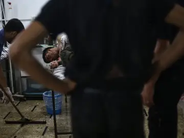 Un joven sirio recibe tratamiento médico en un hospital de campo tras un bombardeo en Douma Un joven sirio recibe tratamiento médico en un hospital de campo tras un bombardeo en Douma