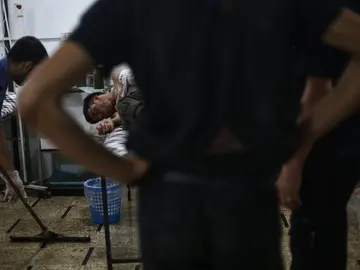 Un joven sirio recibe tratamiento médico en un hospital de campo tras un bombardeo en Douma Un joven sirio recibe tratamiento médico en un hospital de campo tras un bombardeo en Douma