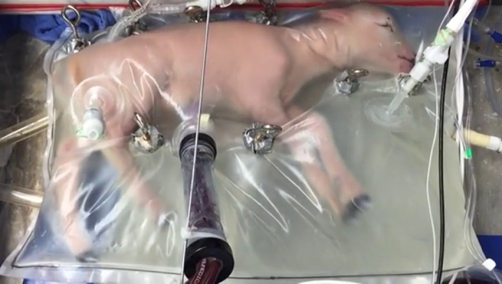 Frame 4.920709 de: Un útero artificial podría aumentar la supervivencia de los niños prematuros