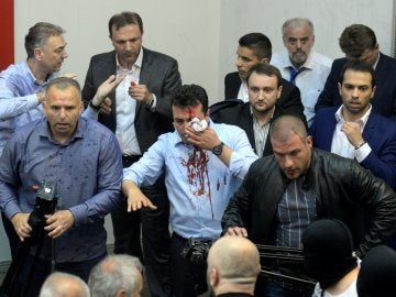 El líder de la Unión Socialdemócrata de Macedonia, Zoran Zaev, es visto con una herida en la cabeza