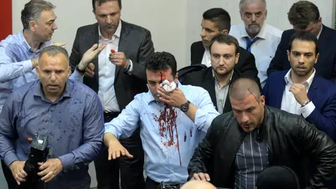 El líder de la Unión Socialdemócrata de Macedonia, Zoran Zaev, es visto con una herida en la cabeza El líder de la Unión Socialdemócrata de Macedonia, Zoran Zaev, es visto con una herida en la cabeza