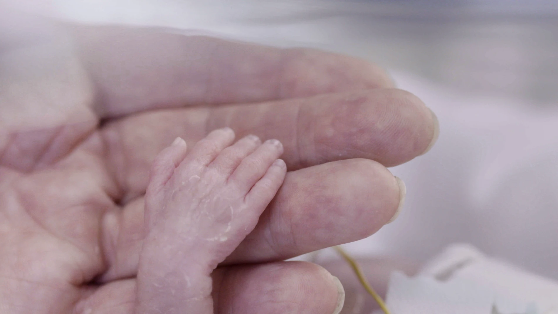Un bebé prematuro Un bebé prematuro
