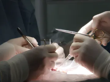 Cirugía en el Hospital La Paz Cirugía en el Hospital La Paz