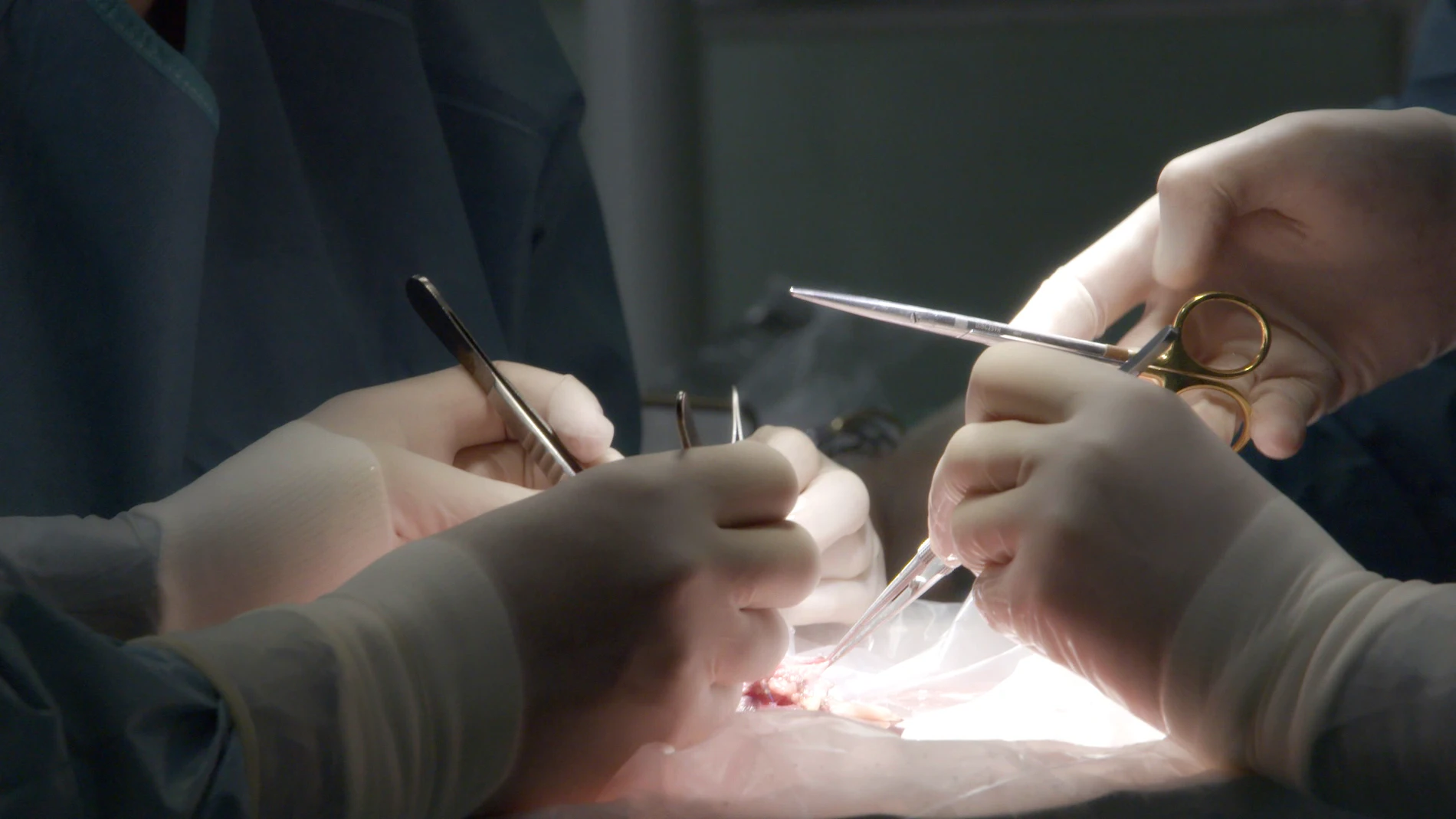 Cirugía en el Hospital La Paz Cirugía en el Hospital La Paz