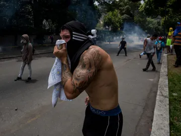 Muere un joven que fue herido en una manifestación en Venezuela Muere un joven que fue herido en una manifestación en Venezuela
