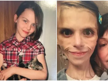 Pippa, la adolescente con anorexia que acabó suicidándose Pippa, la adolescente con anorexia que acabó suicidándose