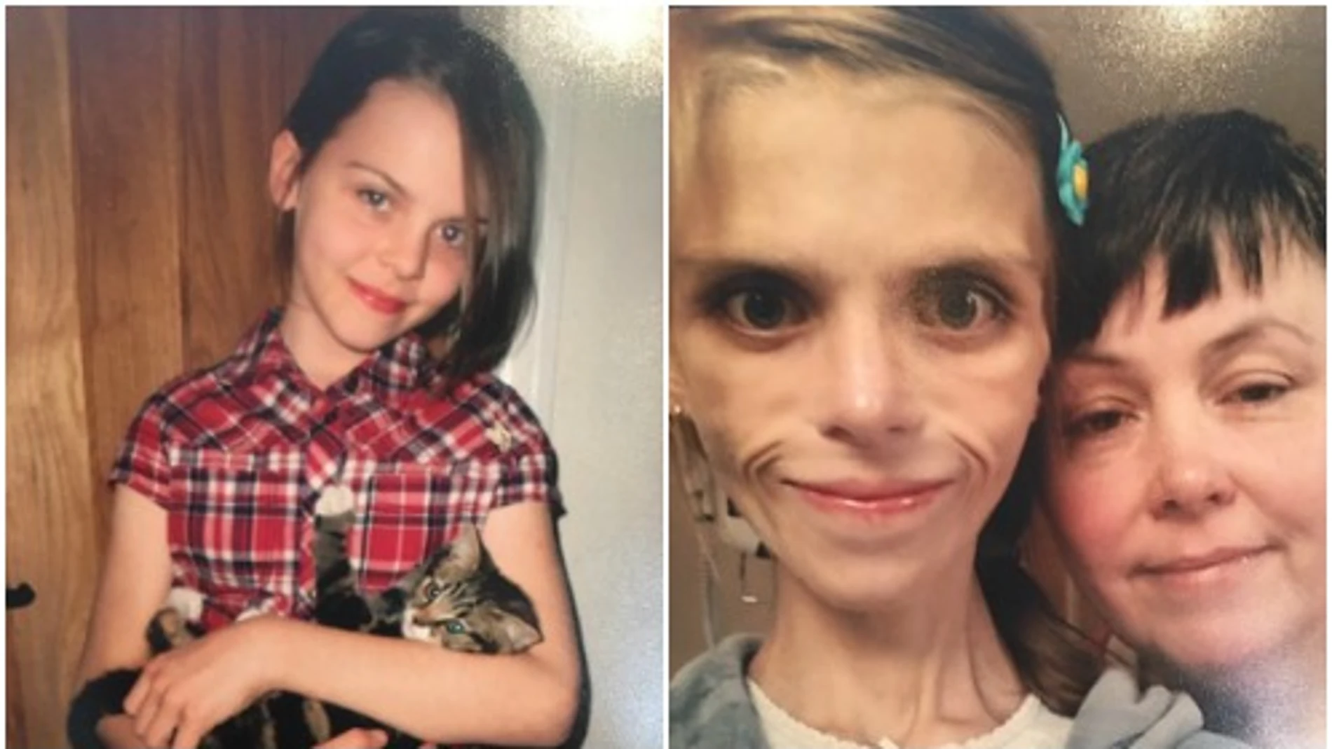Pippa, la adolescente con anorexia que acabó suicidándose Pippa, la adolescente con anorexia que acabó suicidándose