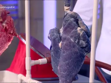 Marta Hazas lleva a 'El Hormiguero 3.0' un pulmón de un fumador para demostrar los daños que causa el tabaco Marta Hazas lleva a 'El Hormiguero 3.0' un pulmón de un fumador para demostrar los daños que causa el tabaco