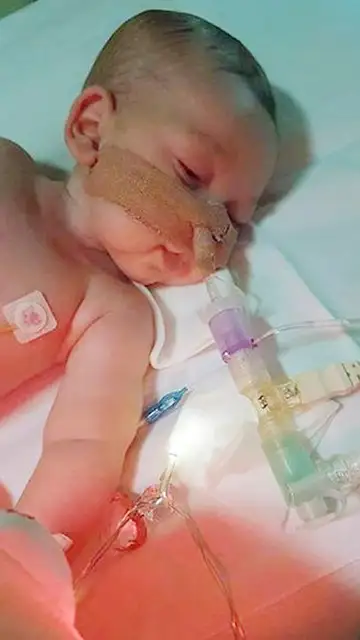 Charlie sufre una enfermedad rara que le causa debilidad muscular progresiva y daño cerebral Charlie sufre una enfermedad rara que le causa debilidad muscular progresiva y daño cerebral