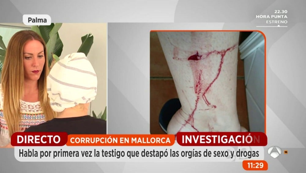 La testigo de la corrupción en Mallorca que destapó las orgías de sexo y drogas: "Me dieron una paliza en el portal de mi casa"