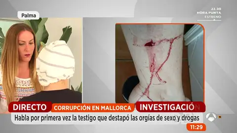 La testigo de la corrupción en Mallorca que destapó las orgías de sexo y drogas: "Me dieron una paliza en el portal de mi casa" La testigo de la corrupción en Mallorca que destapó las orgías de sexo y drogas: "Me dieron una paliza en el portal de mi casa"