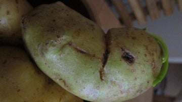 Sí, la patata te puede hacer pupita mala, aunque no te lo creas.