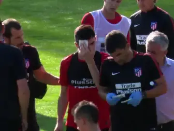 Rubén Fernández, con un corte en la ceja Rubén Fernández, con un corte en la ceja