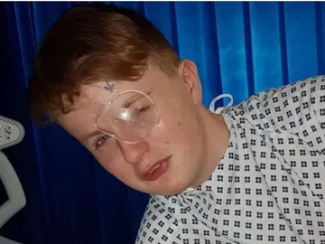 Un niño de 15 años se queda ciego de un ojo después de que un compañero le clavase una pluma Un niño de 15 años se queda ciego de un ojo después de que un compañero le clavase una pluma