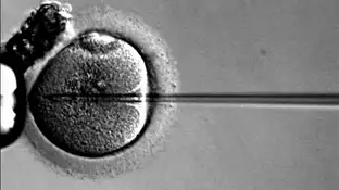 Fecundación in vitro Fecundación in vitro