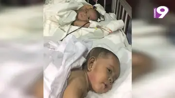 Las gemelas, una vez separadas Las gemelas, una vez separadas