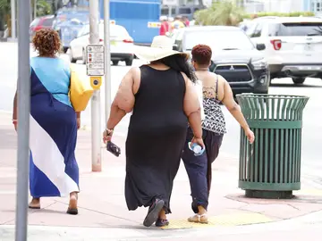 Mujeres con problema de obesidad, imagen de archivo Mujeres con problema de obesidad, imagen de archivo