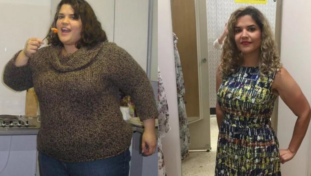 Dieta para personas con obesidad morbida Dieta para personas con obesidad morbida