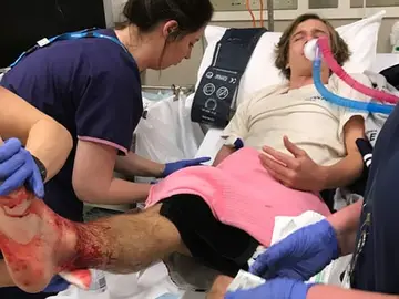 El adolescente, ingresado por la gravedad de las heridas El adolescente, ingresado por la gravedad de las heridas