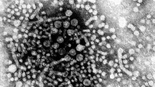 Hepatitis A