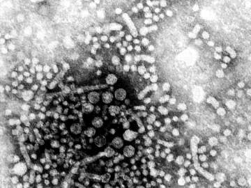 Hepatitis A