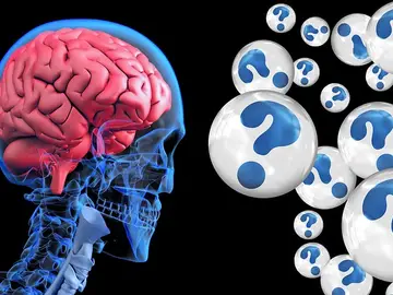 Alzheimer Alzheimer