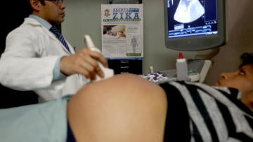 Una mujer embarazada durante una revisión de rutina.
