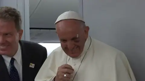 El papa bromeó sobre su golpe: "Tengo el ojo como compota" El papa bromeó sobre su golpe: "Tengo el ojo como compota"