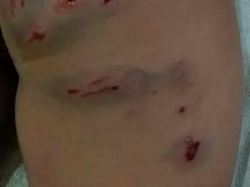 ataque perros ataque perros