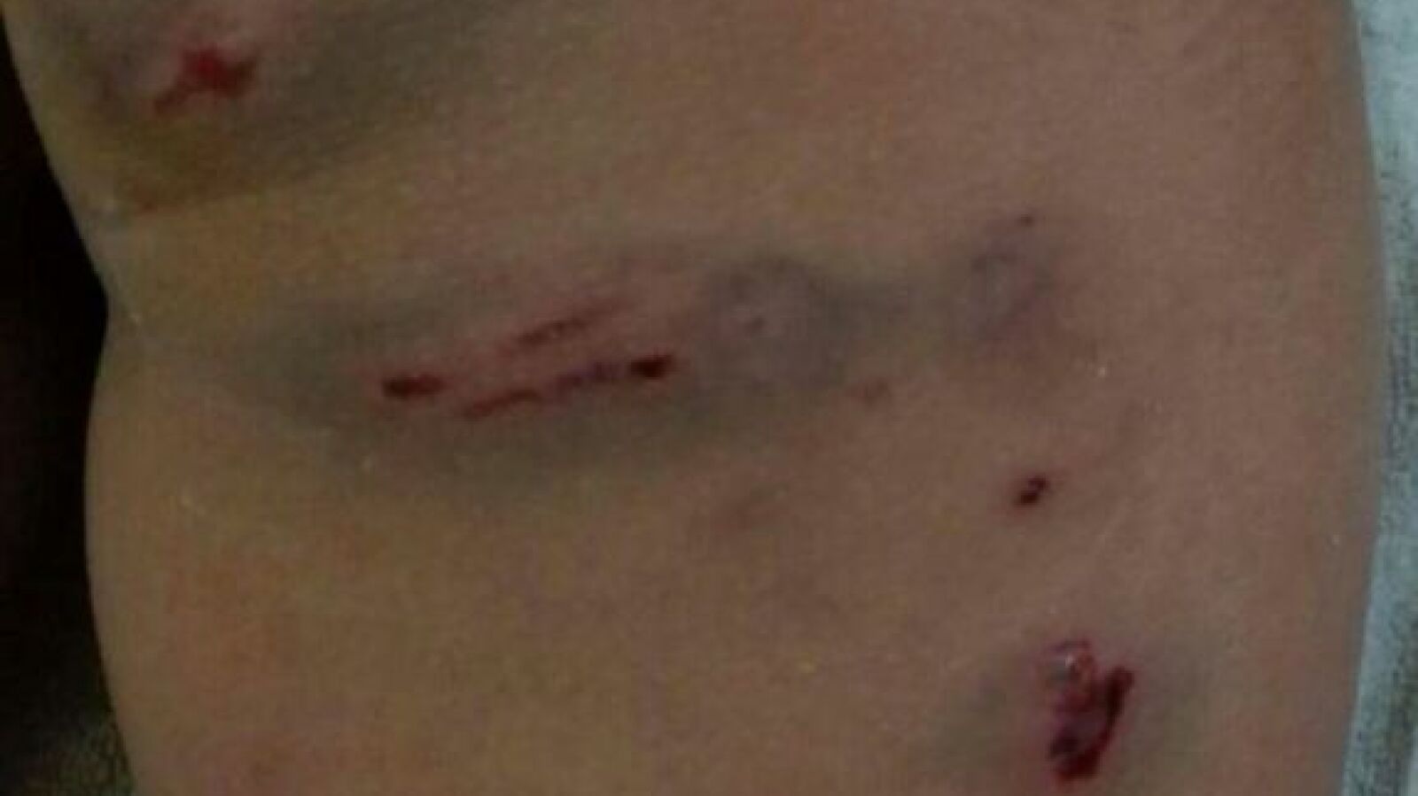Dos perros atacan a una niña de 7 años en un parque