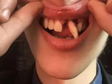 Agresión homófoba en Ciudad Real Agresión homófoba en Ciudad Real