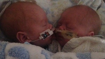 Los bebés prematuros que mejoraron al estar cerca el uno del otro