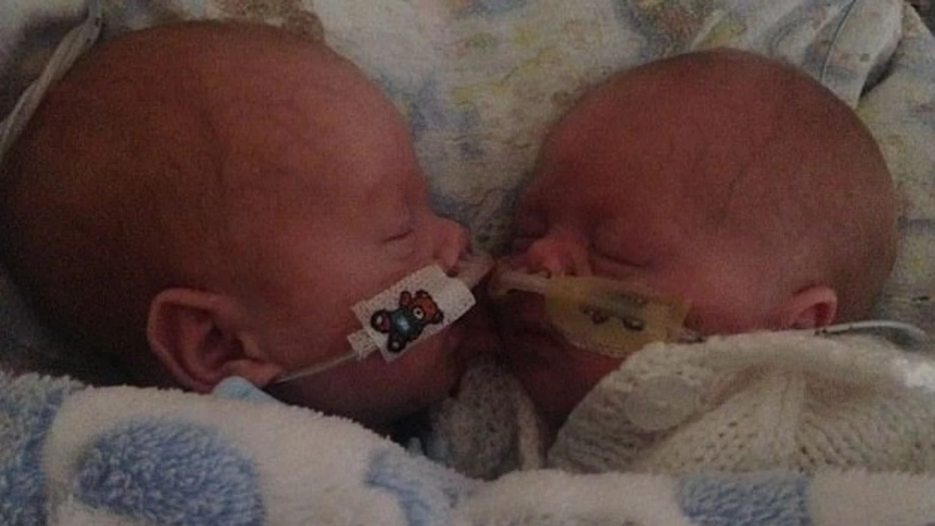 Los bebés prematuros que mejoraron al estar cerca el uno del otro Los bebés prematuros que mejoraron al estar cerca el uno del otro
