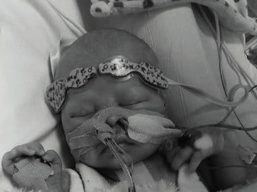 Charlie Douthwaite, el bebé que espera un trasplante de corazón
