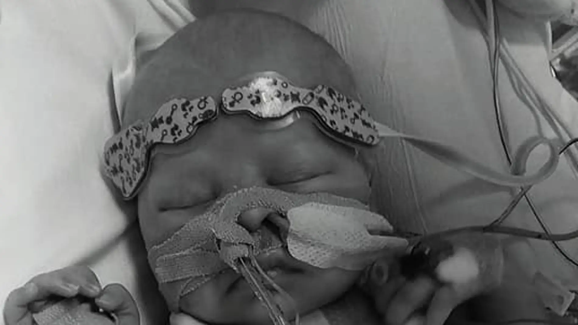 Charlie Douthwaite, el bebé que espera un trasplante de corazón Charlie Douthwaite, el bebé que espera un trasplante de corazón