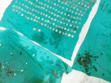 Las monedas y los clavos encontrados en el estómago del paciente Las monedas y los clavos encontrados en el estómago del paciente
