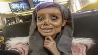 Sahar Tabar, la joven que quería parecerse a Angelina Jolie Sahar Tabar, la joven que quería parecerse a Angelina Jolie