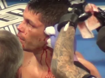 Le parten la oreja a Stephen Smith en un combate Le parten la oreja a Stephen Smith en un combate