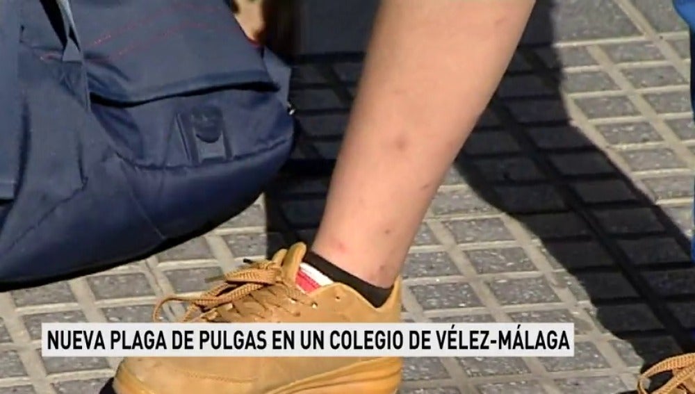 Los padres de un colegio de Málaga denuncian de nuevo la aparición de pulgas