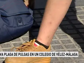 Los padres de un colegio de Málaga denuncian de nuevo la aparición de pulgas Los padres de un colegio de Málaga denuncian de nuevo la aparición de pulgas