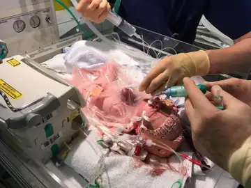 El nacimiento de la niña con el corazón fuera El nacimiento de la niña con el corazón fuera