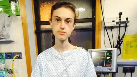 Emelle Lewis, la joven a la que Instagram salvó de la anorexia Emelle Lewis, la joven a la que Instagram salvó de la anorexia
