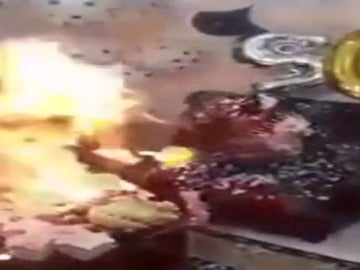 Dos jóvenes heridas al incendiarse la espuma de aerosol durante un cumpleaños Dos jóvenes heridas al incendiarse la espuma de aerosol durante un cumpleaños